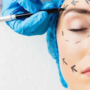 Tecnicas de blefaroplastia
